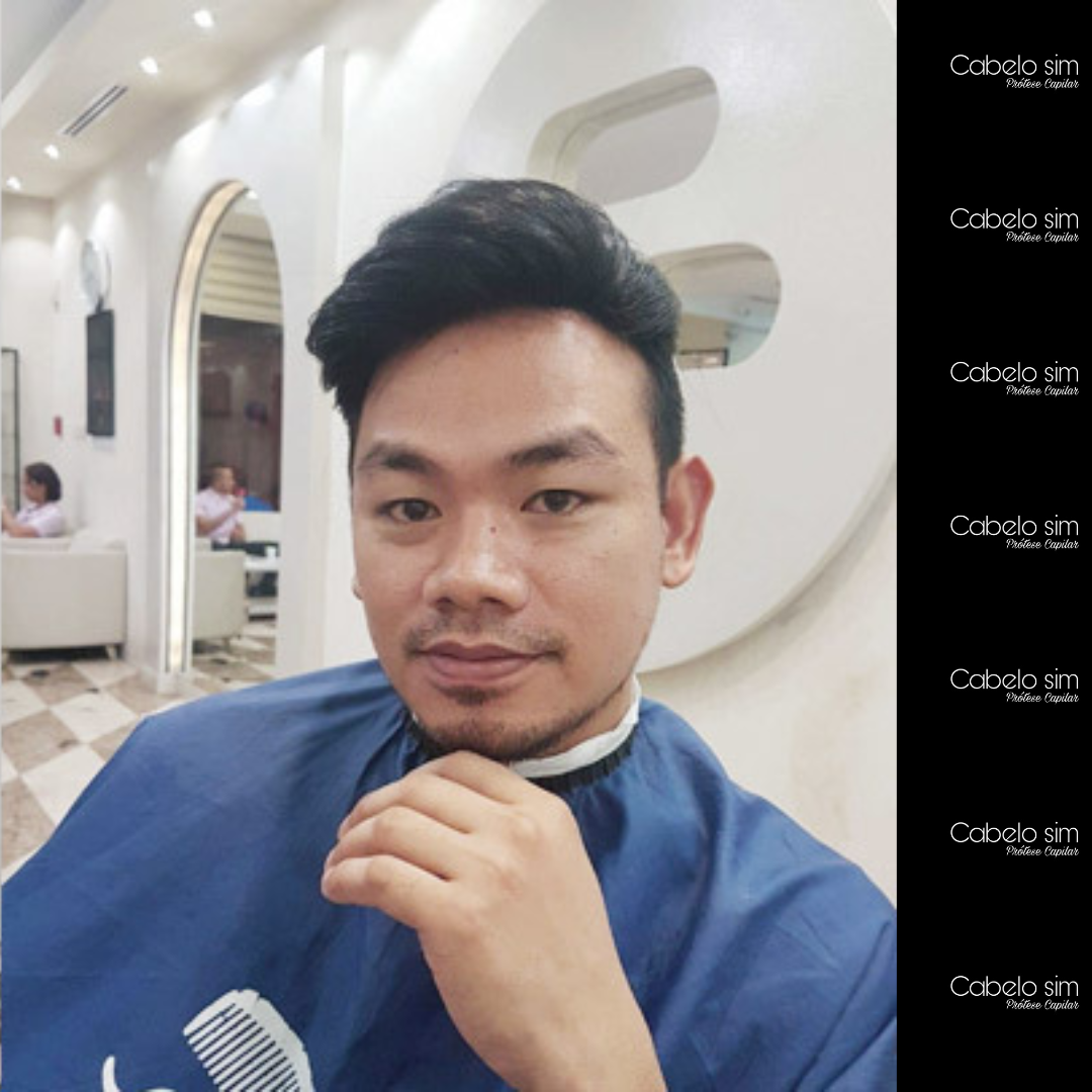 Resultado Grisalho natural — cliente de 52 anos