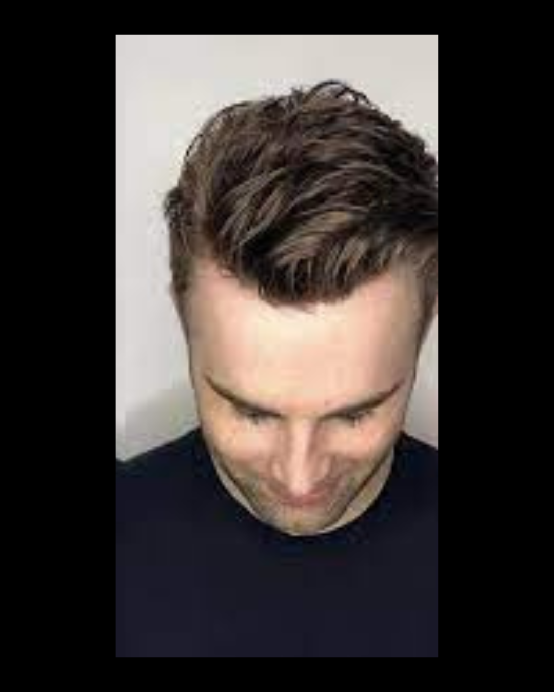 Resultado Estilo urbano — cliente de 31 anos